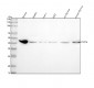 Anti-PD-L1 (CD274) Rabbit Monoclonal Antibody